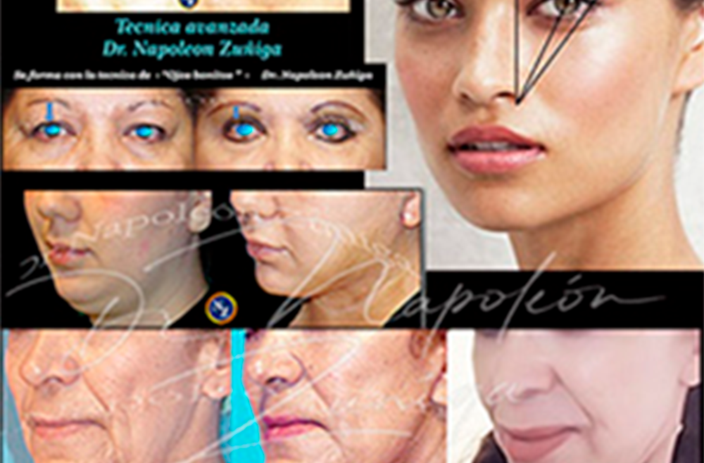 Cirugia facial