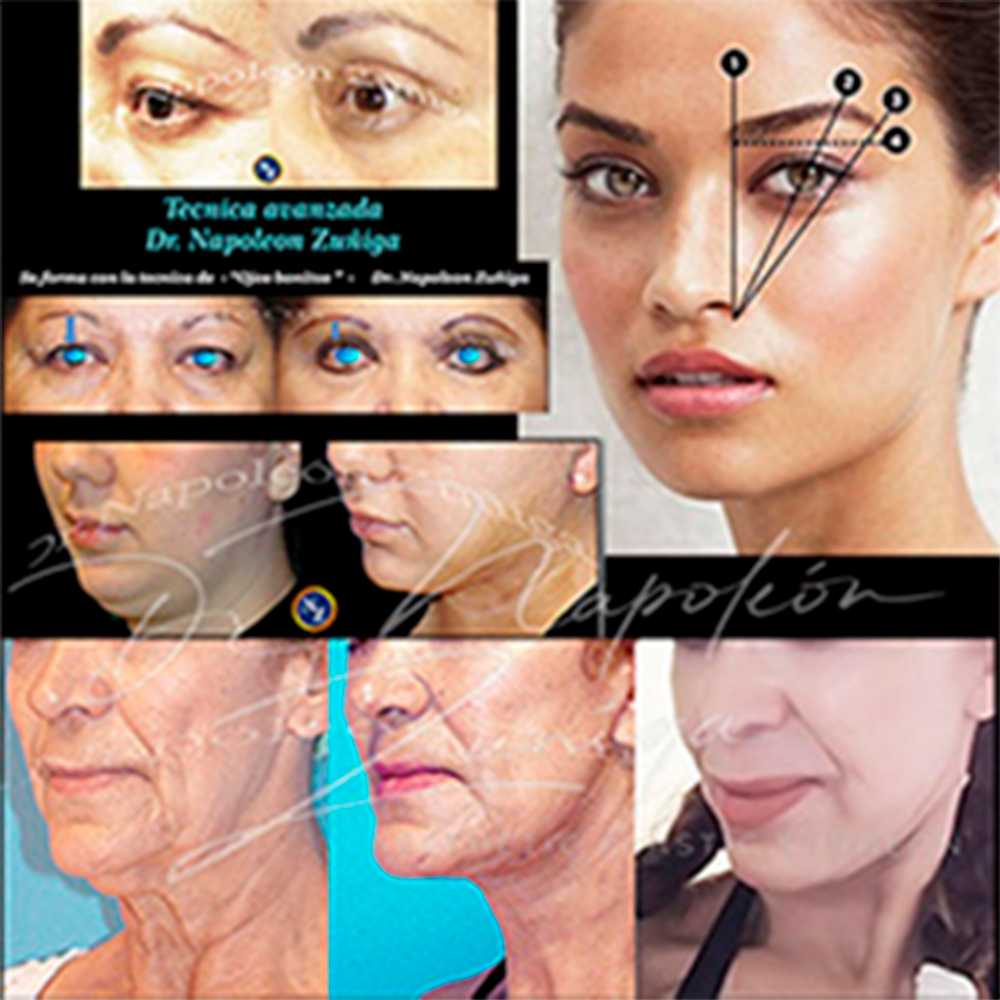 Cirugia facial