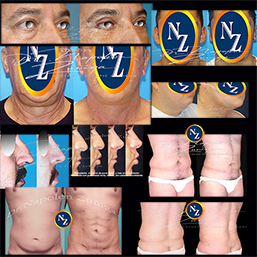 Cirugia-Hombre-Recovered