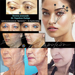 fotos-en-web-clincia-boticdelli
